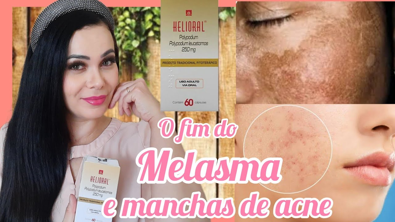 Helioral - filtro solar em cápsulas, clarea melasma e manchas de acne ...