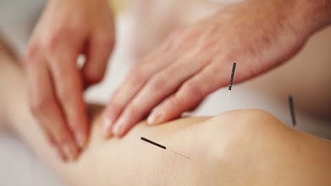 Thực hành châm cứu Đau khớp gối