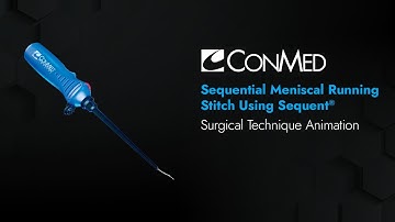 Sequential Meniscal Running Stitch Using Sequent® - CONMED Animation