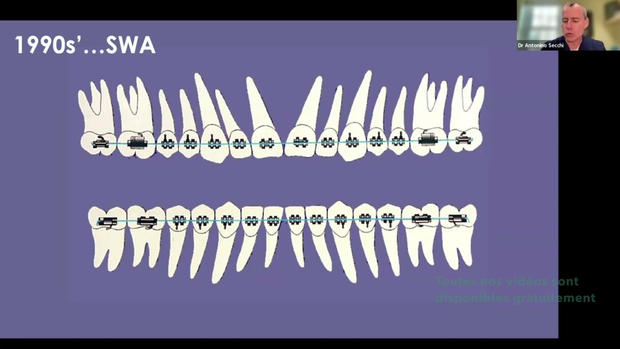 CCO System - Understanding Anchorage & the CCO System