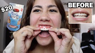 Instant Smile Temporary Tooth Kit - How to fit, an easy guide. 