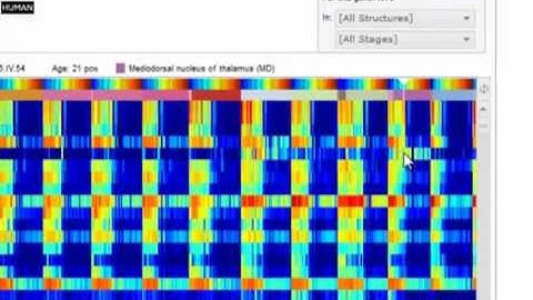 Tutorial: BrainSpan Atlas of the Developing Human Brain