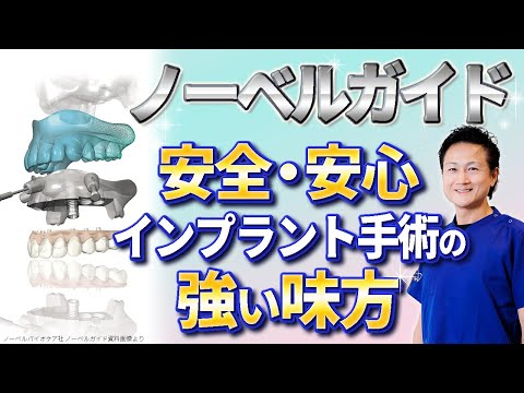 ノーベルガイド使用しますと言われたら見て！【インプラント手術の説明