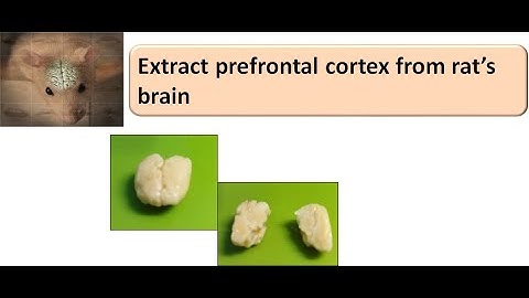 Extract prefrontal cortex from rat