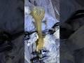 Vaccume and Forcep Delivery