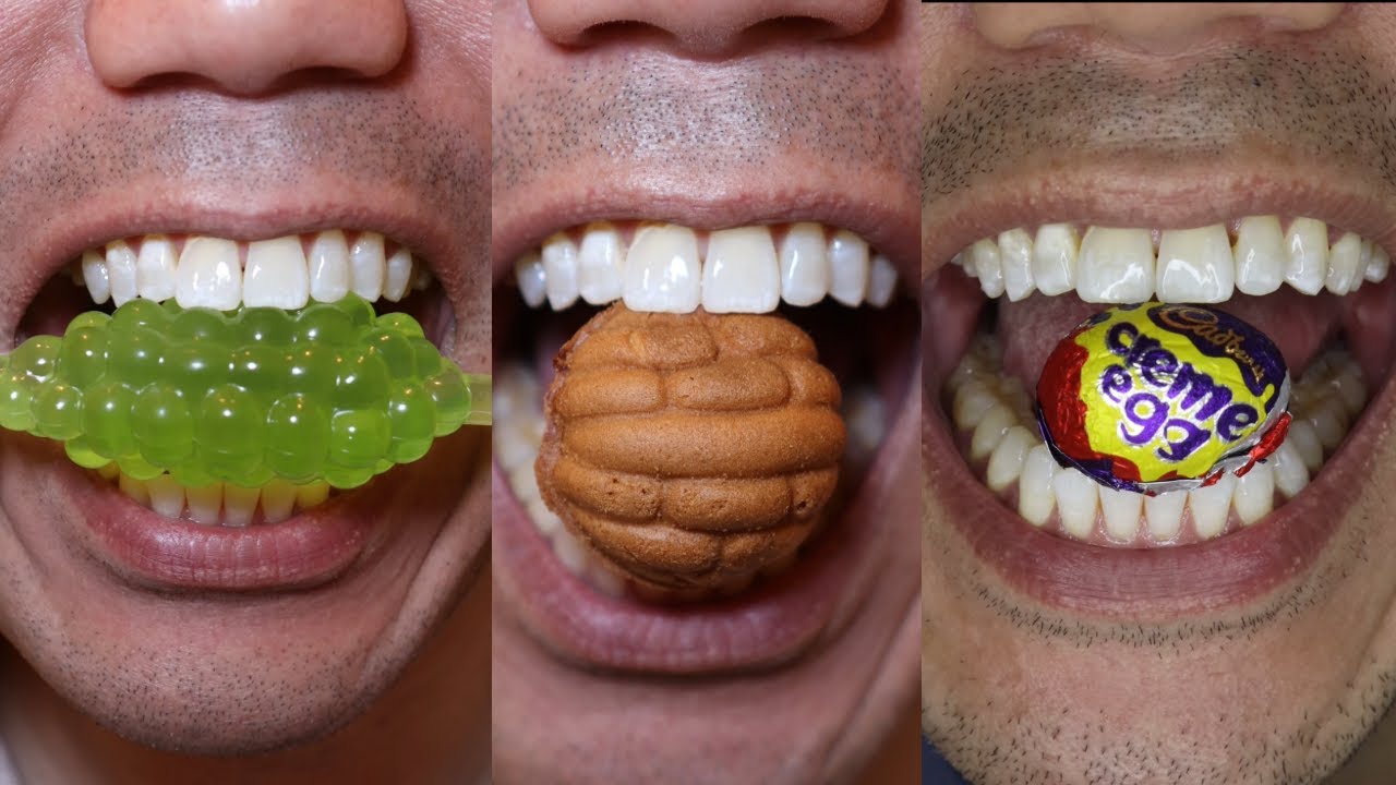 Satisfying Chewing ASMR #Compilation #ASMR #DoctorTristanPeh