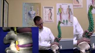 The Chiropractic Basics