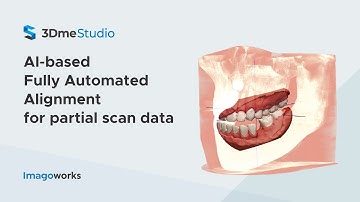 AI-based Fully Automated Alignment for Partial Scan Data | Imagoworks Technology (2021 Jun)