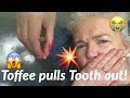Toffee pulls my TOOTH out 😬 Story Time