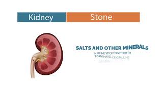 What are Kidney Stones and its Types