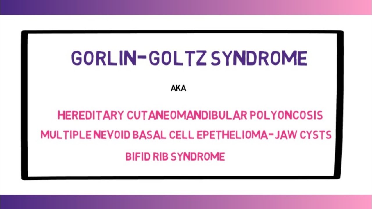 GORLIN GOLTZ SYNDROME | TROOTH | QUICK REVISION