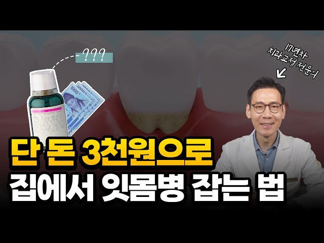 병원에서 안알려주는 잇몸에서 피날 때 집에서 해결하는 법