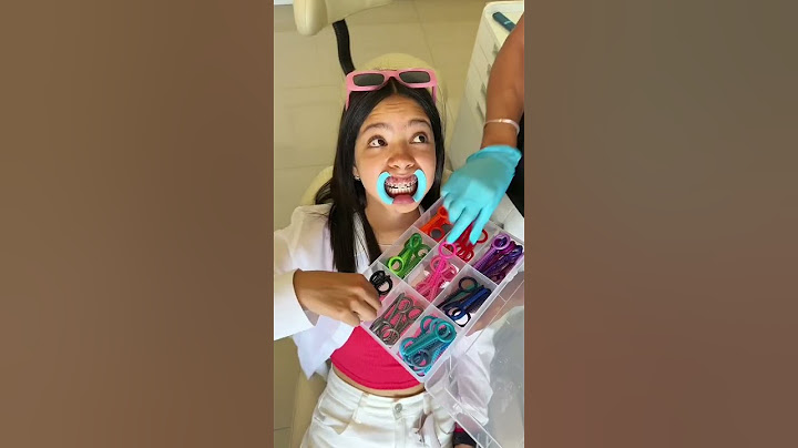 Ustedes tienen o han tenido brackets? cuanto tiempo? 🤣🫶  @seleneguzmanh
