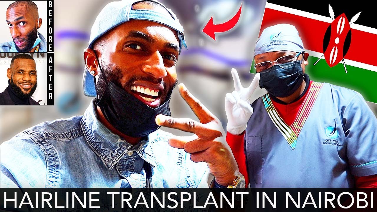 *UPDATE* FUE Hairline Transplant in KENYA 🇰🇪 Bloodwork YouTube