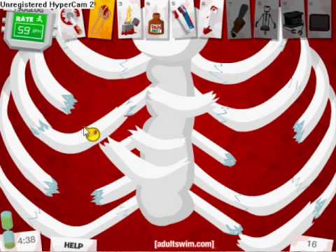 Amateur Surgeon Bleed Walkthrough