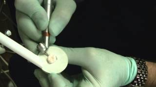 NSK Ti-Max Z45L electric hand piece demonstration by Dr Wolanski