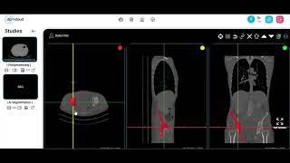 Famous Hip Auto Segmentation Wealth