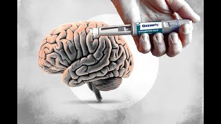 UW ECHO Dementia November 14, 2025: GLP-1 Therapy and the Brain