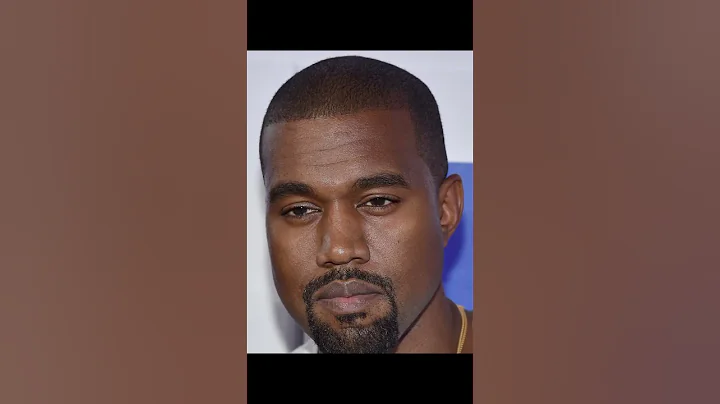 Celebrities BEFORE TheirHair Transplant 😱