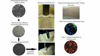 Nanostructured MSC hydrocolloid dressing for burn treatment - Video abstract [ID 289868]