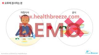 [시연용] b0099aako_심근 스펙트검사(SPECT) 안내