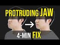 Protruding jaw  underbite fix facial asymmetry correctioncorrective exercises