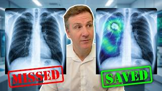 The End of Missed Diagnoses? AI vs. Human Error
