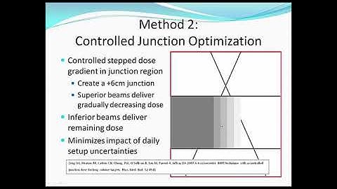 Set-up Uncertainties for Multiple Isocenters IMRT Plans #radiotherapy