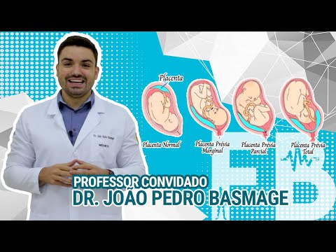 Placenta Prévia - Prof. Convidado Dr. João Pedro Basmage