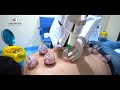 Hijama  cupping in eve medical centre uae