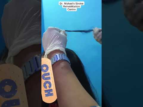 HAIR SCALP CRACKING