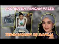 ANAK 9 TAHUN YANG HARUS RELA KEHILANGAN TANGAN DAN AYAHNYA