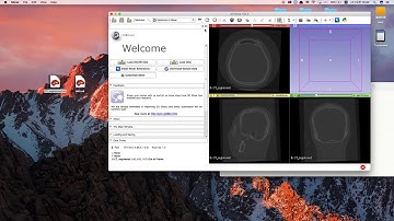 Tutorial of 3D Slicer (install and simple modeling)