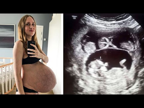 Video: Sherlyn Heeft Al Een Zwangerschapsbuik