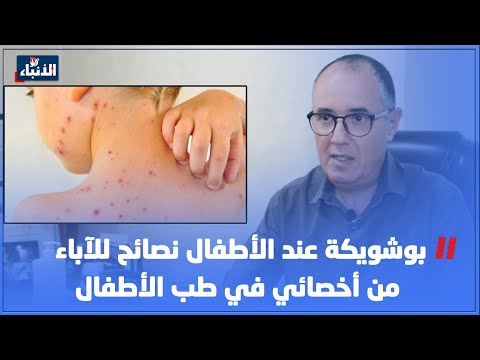 بوشويكة عند الأطفال نصائح للآباء من أخصائي في طب الأطفال