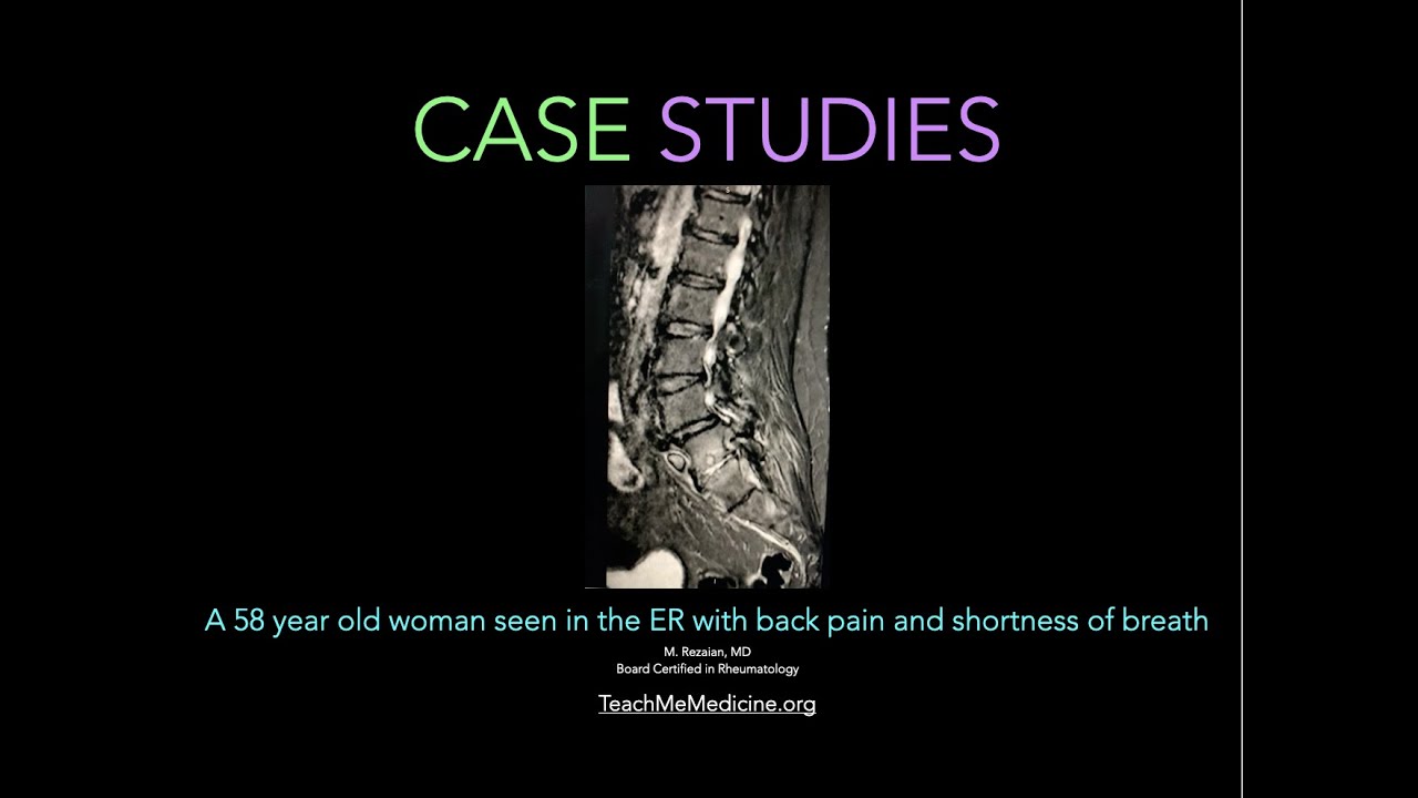 Case Studies: A 58-year-old woman is seen in the ER because of back ...