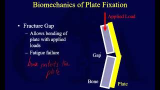 Orthopaedic Implants 1