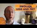 Multiple Sclerosis Symptoms Video: Swollen Legs and Feet