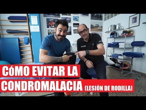 Evitar la Condromalacia (Lesión de Rodilla Común)