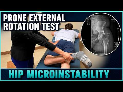 Prone External Rotation Test | Hip Microinstability