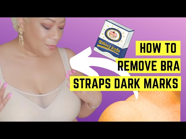 How to Get Rid of Bra Strap Marks Naturally  Bra straps, Mask for oily  skin, Skin marks