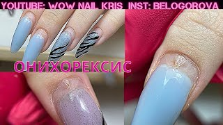 картинка: Трещина у кутикулы-Онихорексис | Как не вестись на поводу у клиентов | Исправляем дефект