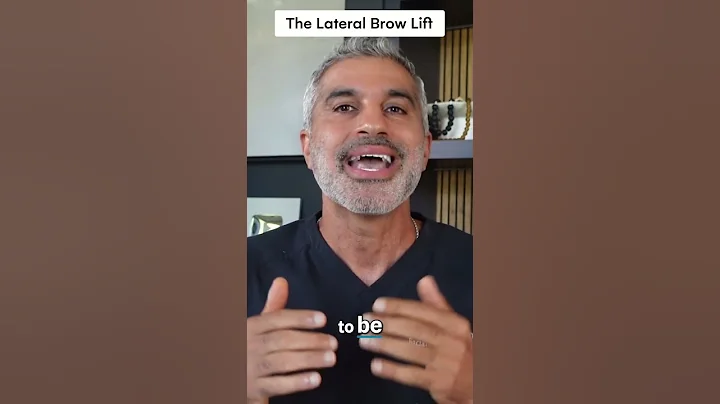 Thinking of an Endoscopic Brow Lift? What I Recommend Instead for a Natural Look