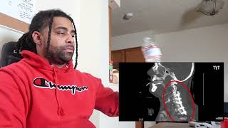 CA Cops Sued $20 Million After Breaking Man's Neck