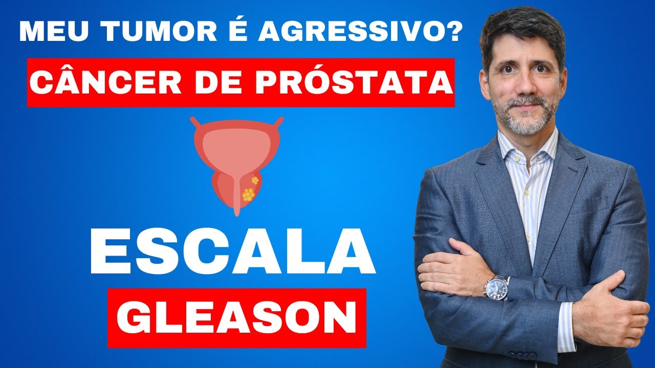 ESCALA DE GLEASON PODE AJUDAR A DECIDIR O MELHOR TRATAMENTO PARA O ...