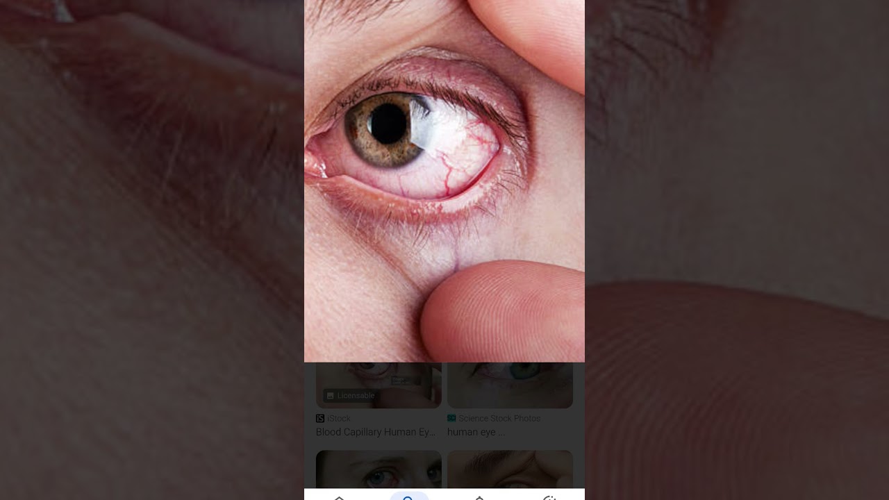 советы по проблемам со зрением