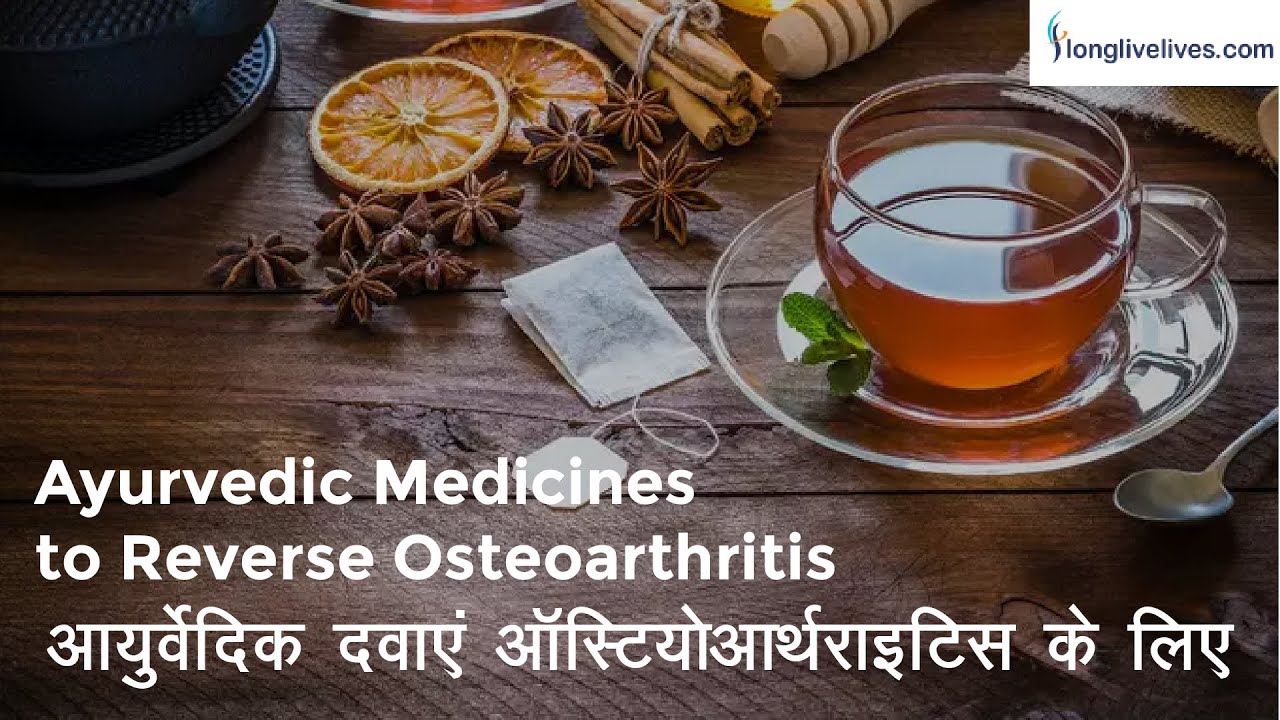 Ayurvedic Medicines to Reverse Osteoarthritis- Osteoarthritis Treatment