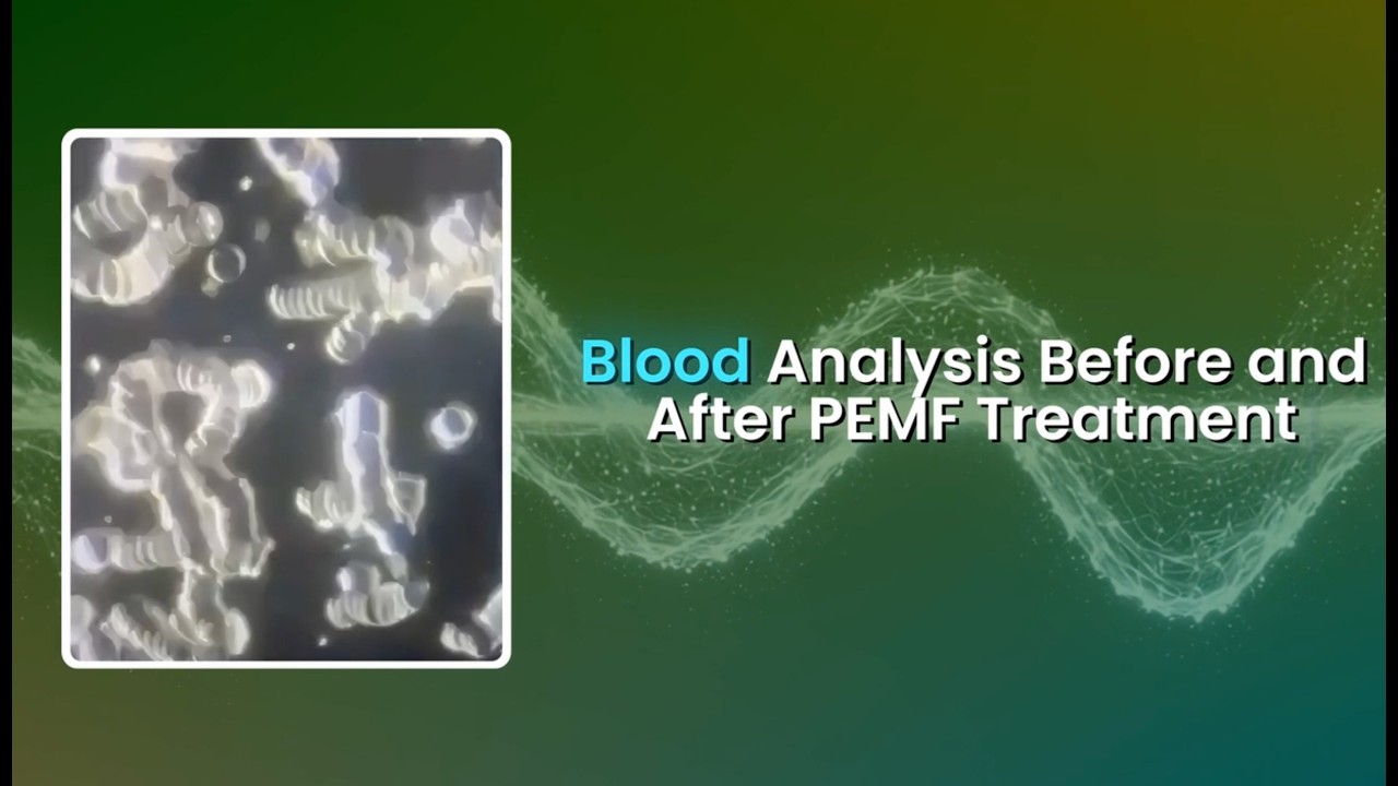 What Changes After PEMF? Blood Analysis Overview