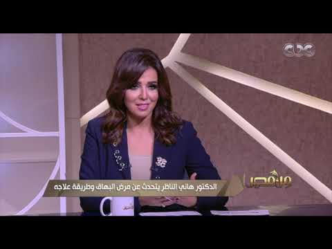 د هاني الناظر مرض البهاق ليس خطيرا وليست له مضاعفات ولكن تأثيره النفسي هو المشكلة من مصر