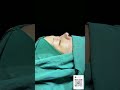 MTF鼻子变好看的秘密 #mff #mtf #ts #massage #skincare #hospital